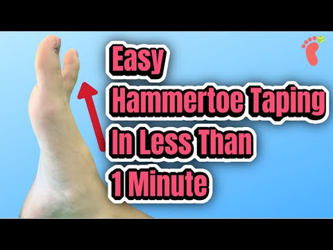 How to Tape a Hammertoe in Less Than 1 Minute | Hammertoe Taping Tutorial