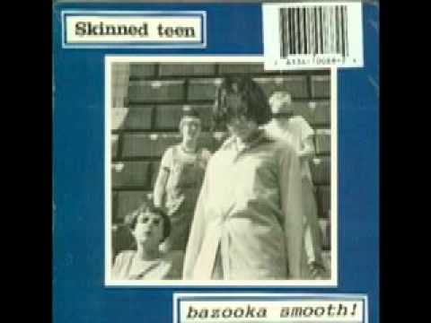 Skinned Teen - "Pillowcase Kisser"