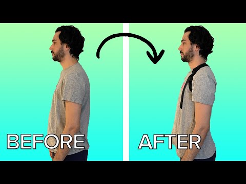 Gamers Try Posture Correctors For A Week