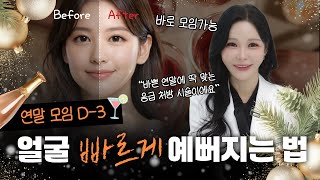 연말 D-7 긴급처방? 일주일 만에 얼굴 확 바뀌는 시술 조합 (ft.닥터오블리)