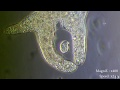 Amoeba Eats Paramecia Amoeba S Lunch Amoeba Endocytosis Phagocytosis Part 1