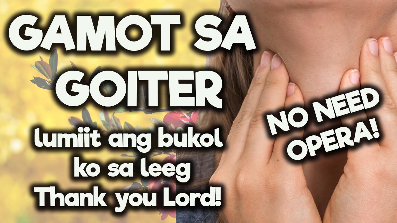 GAMOT SA GOITER / Lumiit ang bukol ko sa leeg!