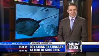 Boy stung by stingray, has surgery to remove barb