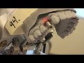 Implant Impressions
