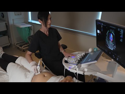GE Voluson-22 Ultrasound