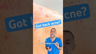 Download lagu How to get rid of back acne mp3