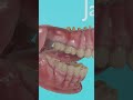 How to blow the perfect bubblegum