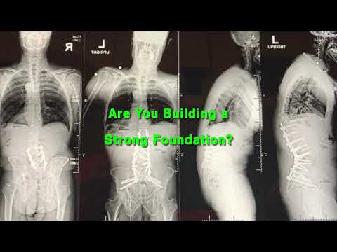 iFuse Bedrock™ - Fixation. Fusion. Foundation