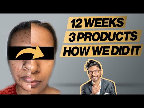 Skincare Routine Before & After 12 Weeks