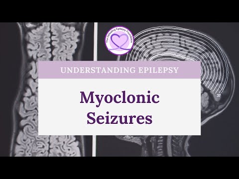 What are Myoclonic Seizures?