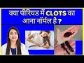 क्या पीरियड में CLOTS का आना नॉर्मल है
