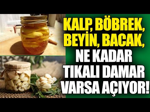 , title : 'Kalp, Böbrek, Beyin, Bacak, Ne Kadar Tıkalı Damar varsa Açıyor!'