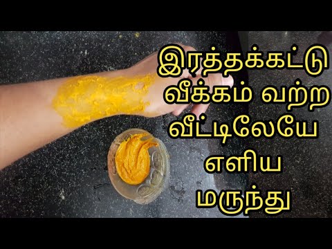 Blood clotting or swelling home remedy |veekam kuraya