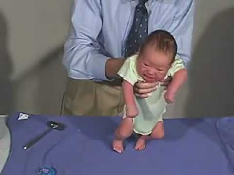 3.25 - Primitive Reflexes, Stepping Reflex - Newborn Normal - Infant Clinical Examination(MRCP)