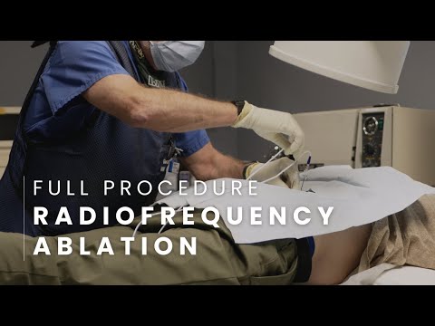 Radiofrequency Ablation Full Procedure - Lumbar