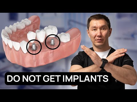 Teeth Whitening Procedure