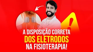 ELETROTERAPIA: Saiba a disposição correta dos ELETRODOS na FISIOTERAPIA!