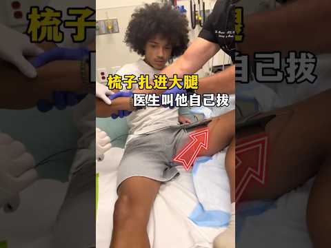 Comb stuck in his thigh and the doctor told him to pull it out himself? #shorts #funny #interesting