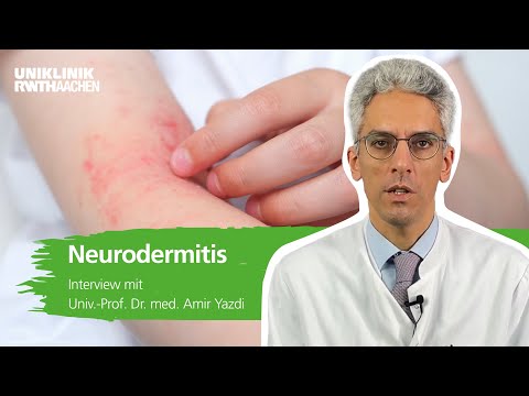 Atopic dermatitis: Prof. Yazdi answers the most important questions