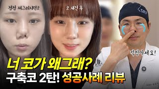 유튜브 검색 그만하세요. 구축코 재건은 이 영상 하나로 종결합니다!