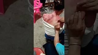 Download lagu #kerokan #cupping #massage #shortvideo mp3