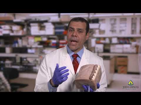 Ultrasound-Guided Percutaneous Nephrolithotomy Model | SLICE