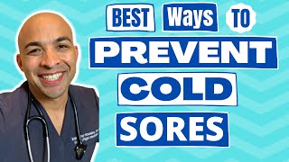 How to Prevent Cold Sores? | Natural and Prescription Options