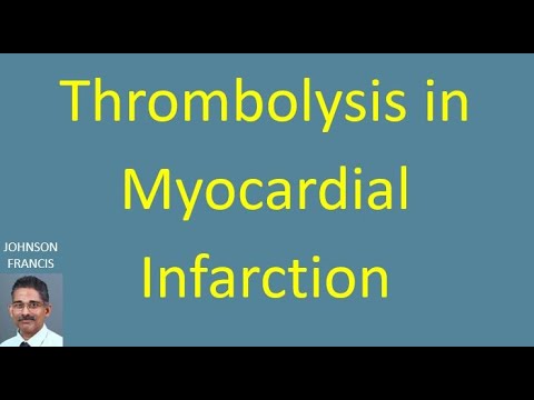 Thrombolysis in Myocardial Infarction