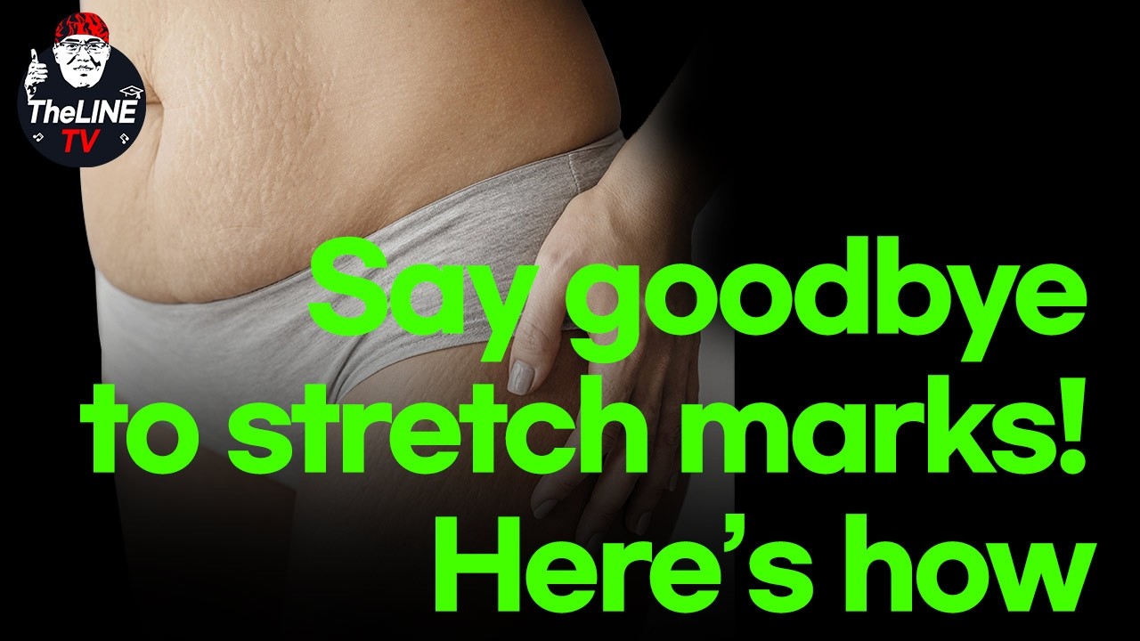 Say goodbye to stretch marks! - TheLINE Plastic Surgery video