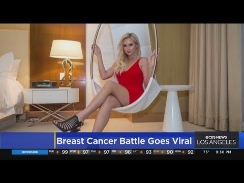 Breast cancer survivor's story goes viral
