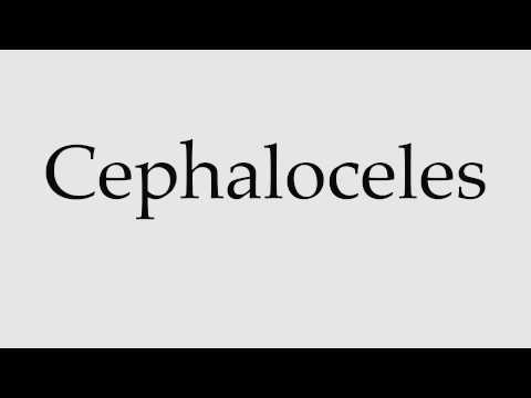 How to Pronounce Cephaloceles