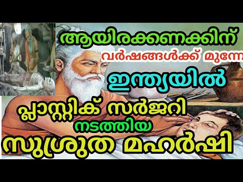 സുശ്രുത മഹർഷി |Susrutha is the father of Surgery and Plastic Surgery