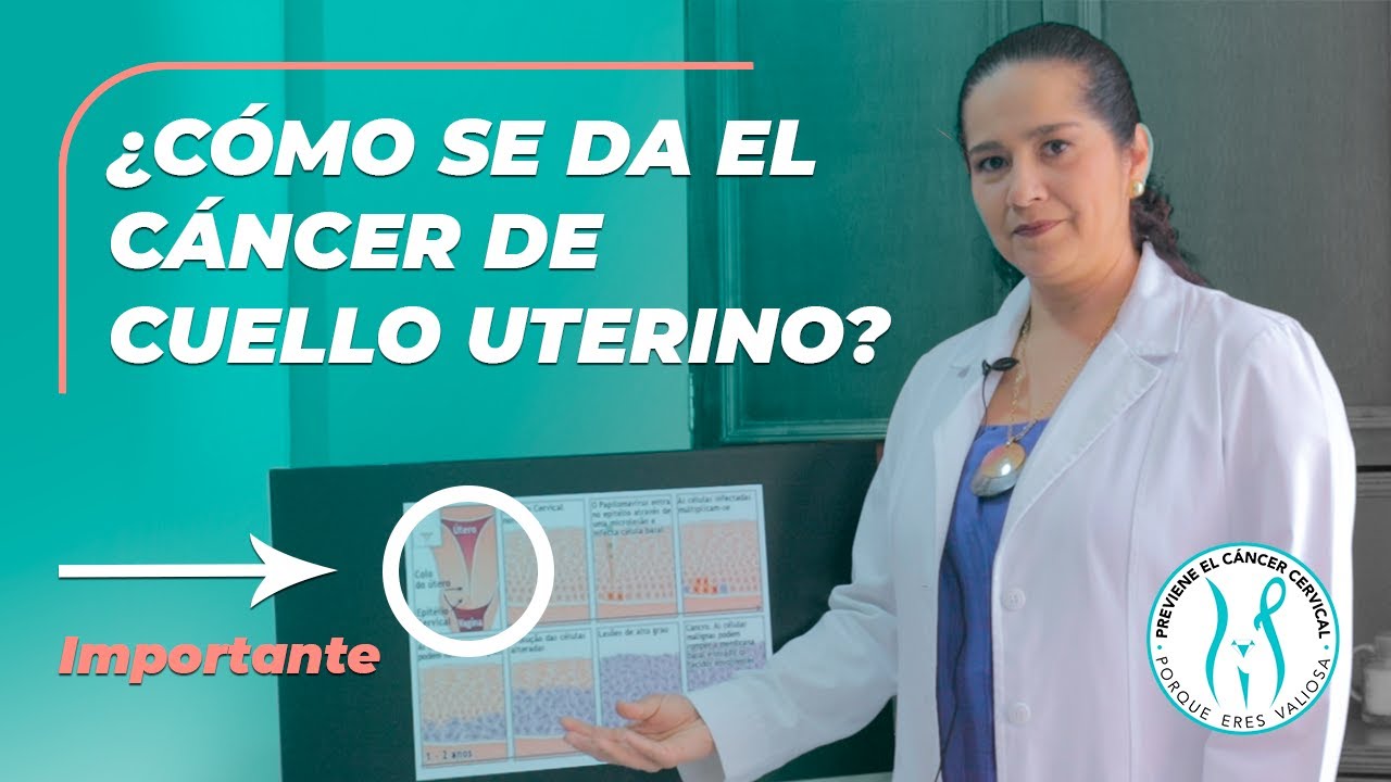 ¿Por qué se da el cáncer de cuello uterino? (Explicación completa)🎗️