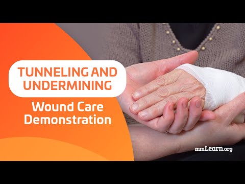 Tunneling and Undermining - Wound Care Demonstration