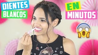 DIENTES MÁS BLANCOS EN MINUTOS ♥ | Yarissa