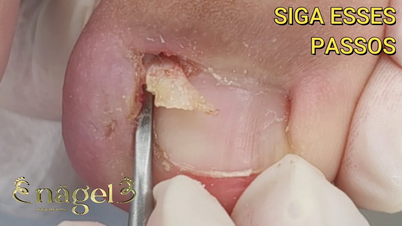 PASSO A PASSO PARA O SUCESSO NA PODOLOGIA #satisfying #nails