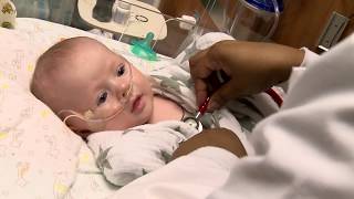 Bronchopulmonary Dysplasia