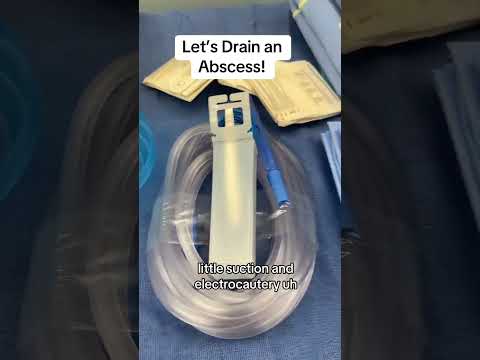 Perirectal abscess drainage.#perianalabscess #analfistula