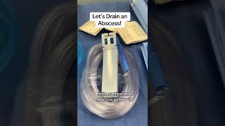 Perirectal abscess drainage.#perianalabscess #analfistula