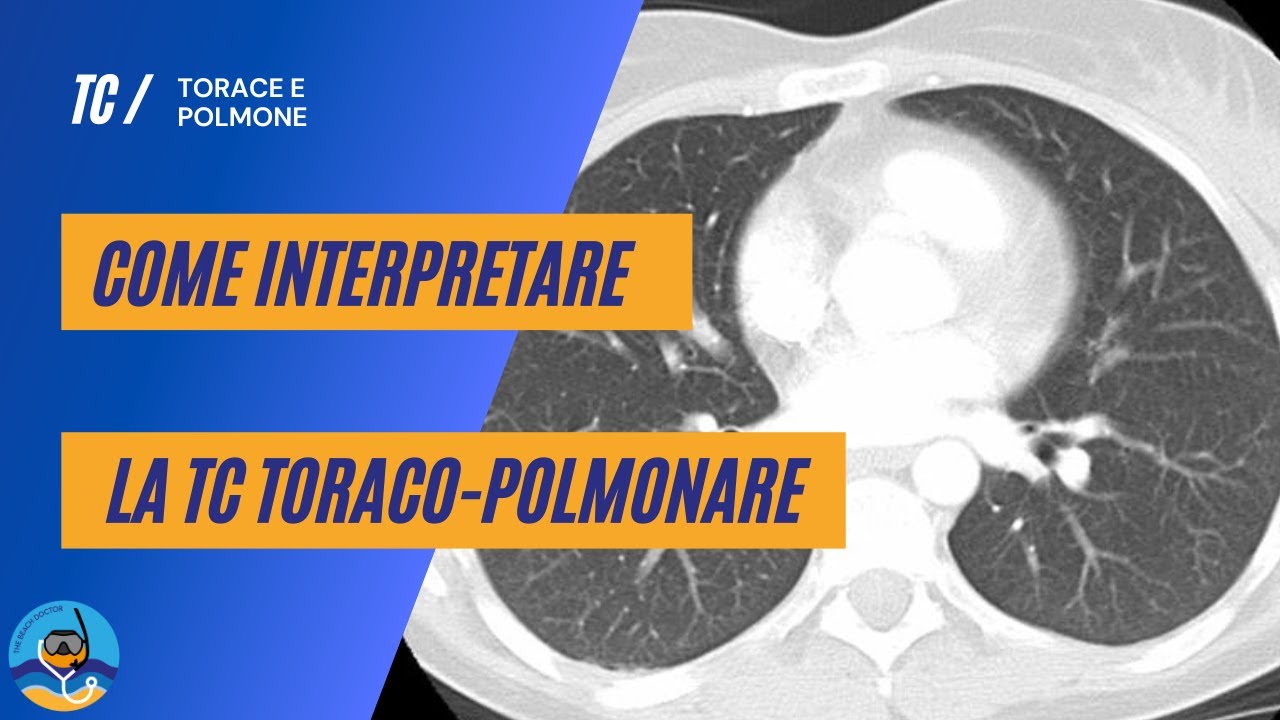 Come interpretare la TC toraco-polmonare