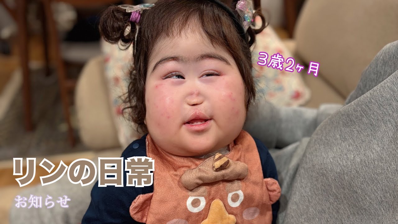 【日常】入院前のリンの日常です/リンダンス♪