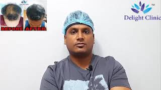 Client feedback of PRP(Platelet Rich Plasma) for Hair loss