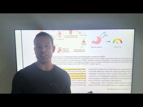 Atualizações sobre Síndrome do ovário policístico 