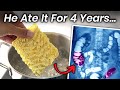 A Boy Ate Instant Noodles For 4 Years This Is What Happened To His Stomach