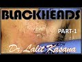 BLACKHEAD REMOVAL PART 1 BY DR.LALIT KASANA