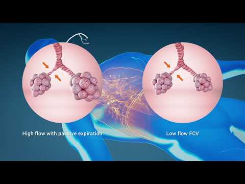 Ventinova FCV: Full respiratory control