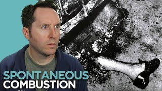 Spontaneous Human Combustion – Could You Burst Into Flames?