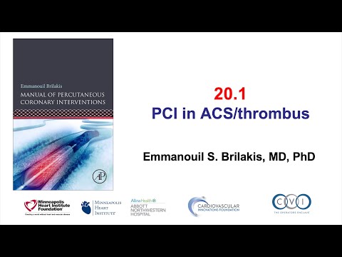 20.1 PCI in ACS patients: Manual of PCI