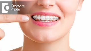Will Invisible Braces correct an overbite? - Dr. Bobby Thomas