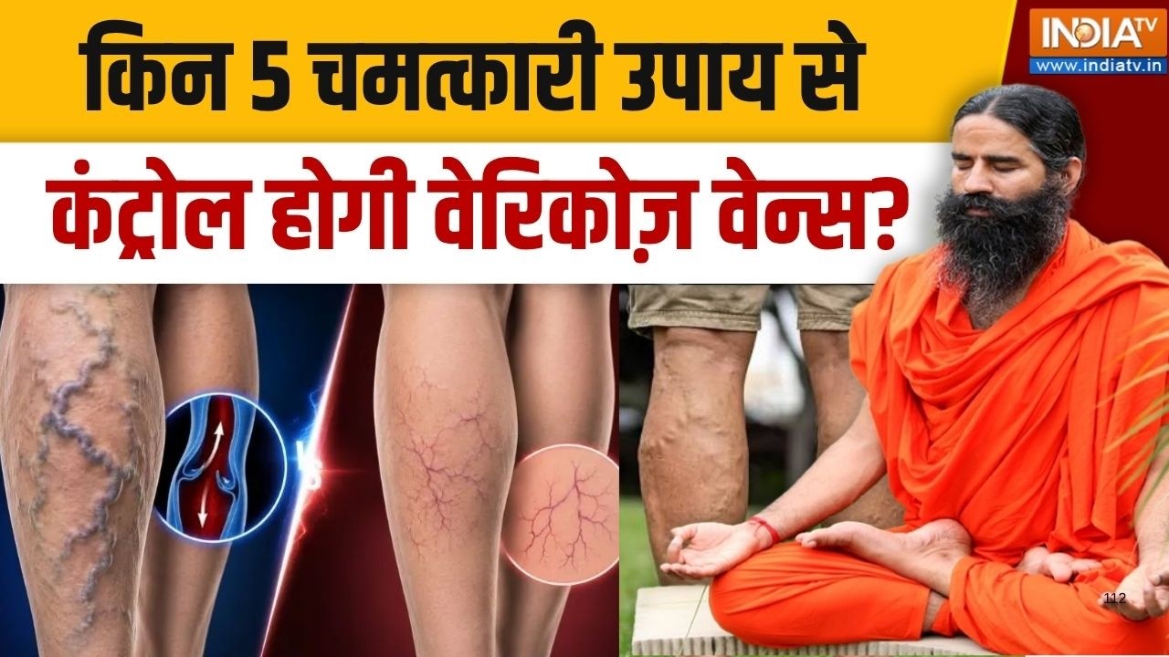 Yoga With Swami Ramdev LIVE:  किन 5 चमत्कारी उपाय से कंट्रोल होगी Varicose veins? | 